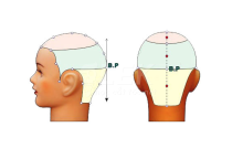 Ph&acirc;n T&iacute;ch Điểm Lồi L&otilde;m Tr&ecirc;n Hộp Sọ (Head Mapping)