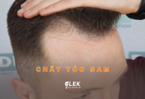 Ph&acirc;n biệt loại chất t&oacute;c nam v&agrave; một số c&aacute;ch chăm s&oacute;c t&oacute;c nam cơ bản